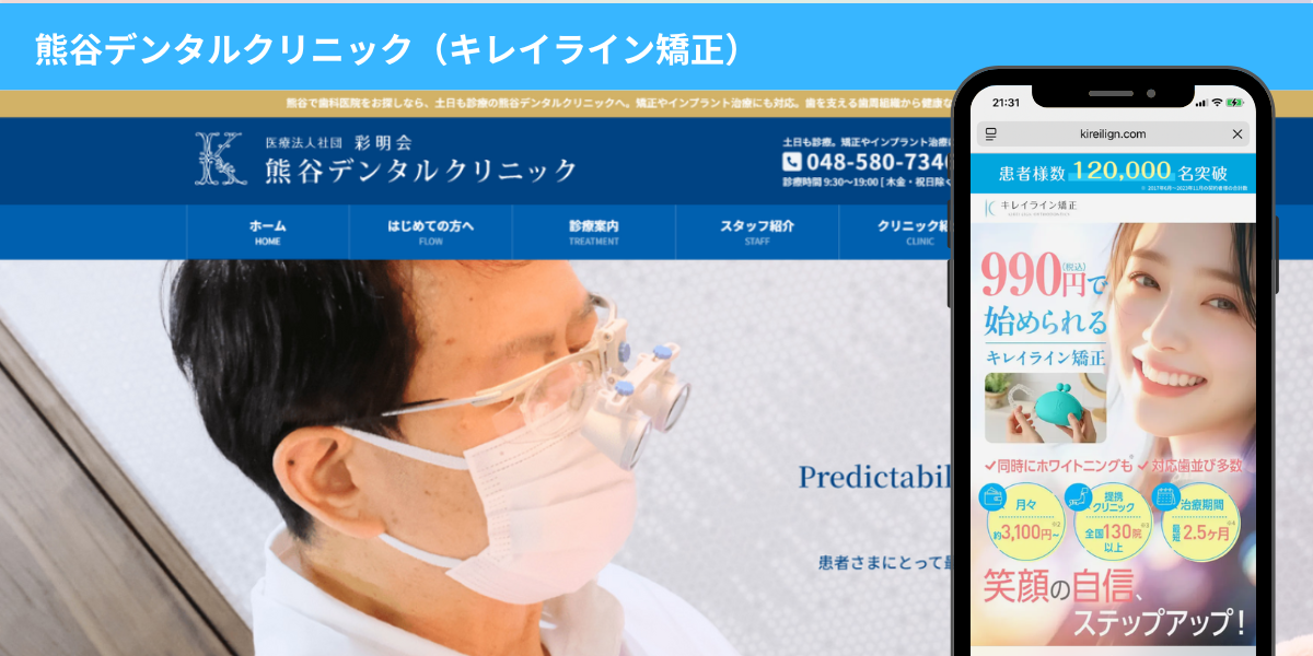 熊谷デンタルクリニック 大宮市近くのキレイライン矯正