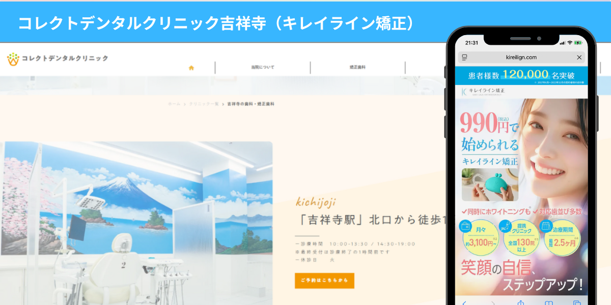 コレクトデンタルクリニック吉祥寺（キレイライン矯正）