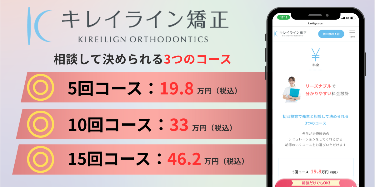 キレイライン矯正の料金プラン