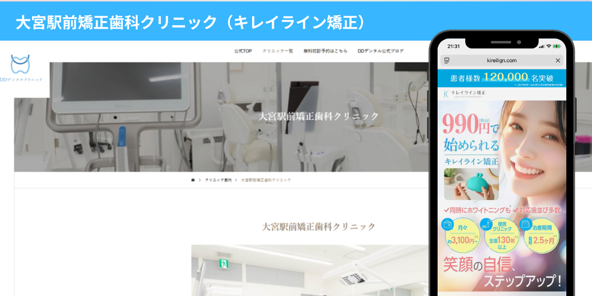 大宮駅前矯正歯科クリニック 大宮市近くのキレイライン矯正