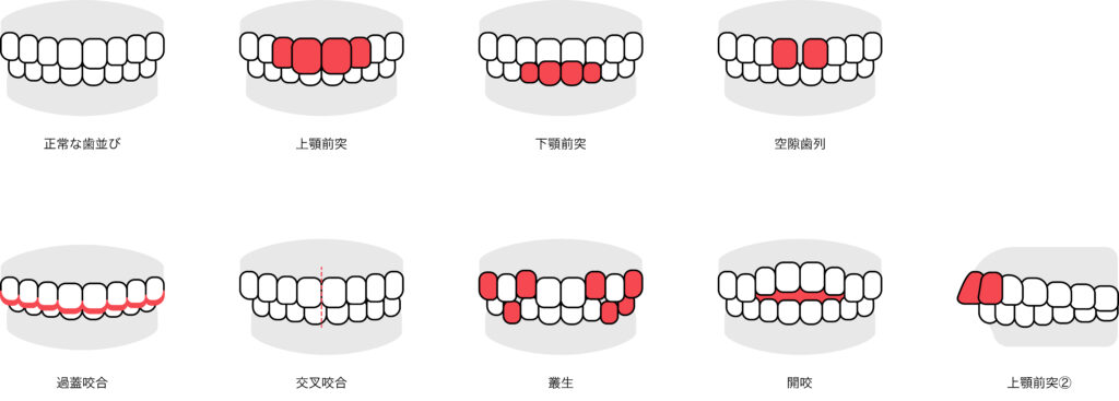 Oh my teeth(オーマイティース)