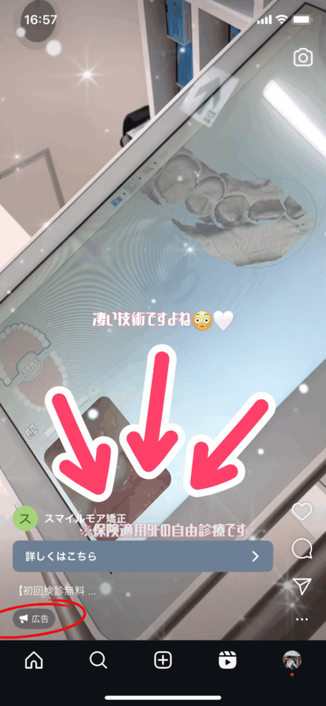 oh my teeth 6ヶ月無料