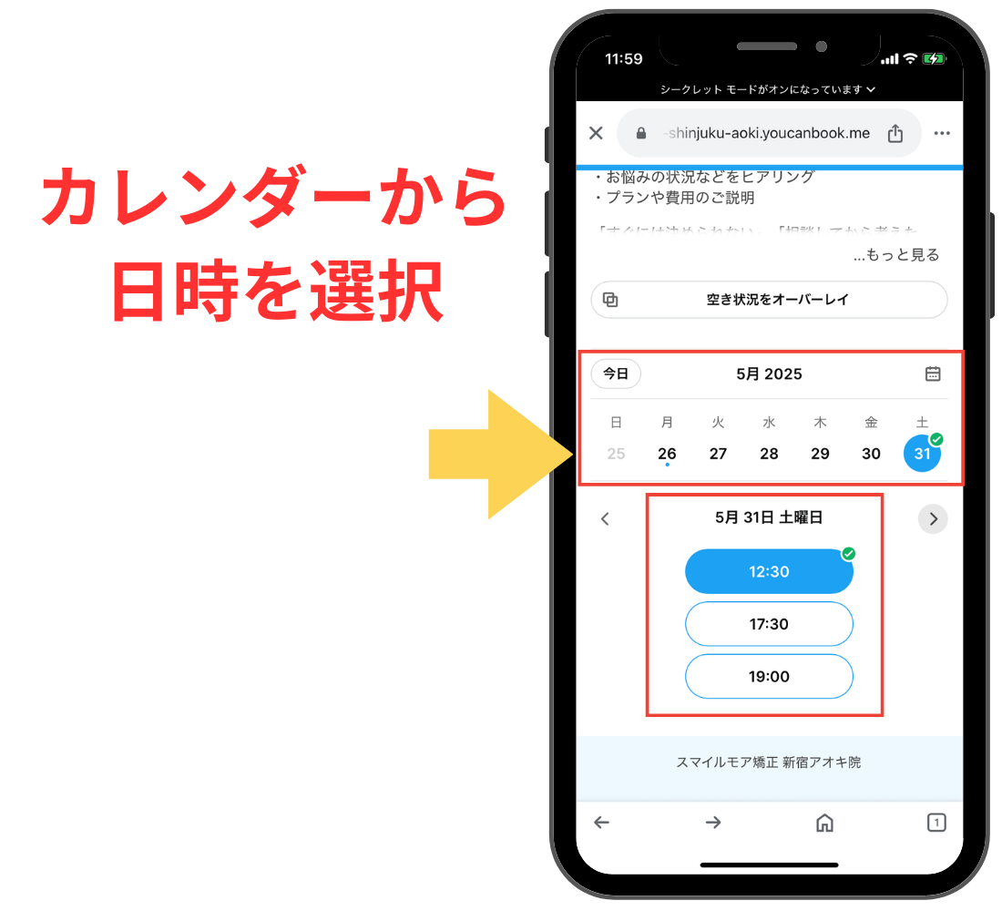 スマイルモア矯正で無料診断予約の流れ