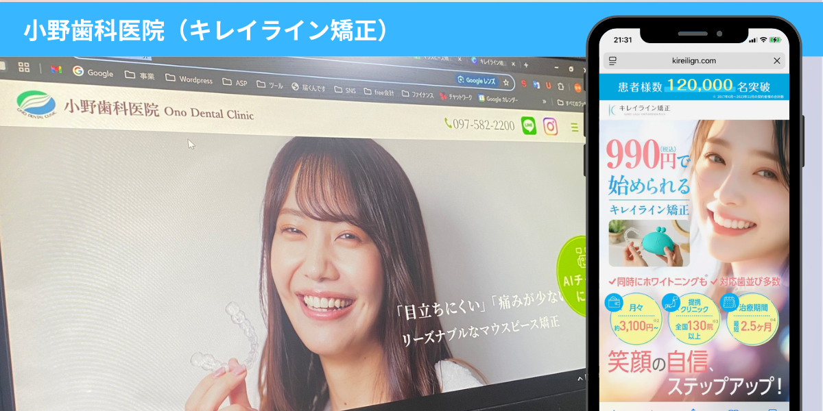 小野歯科医院の口コミ｜大分県のキレイライン矯正