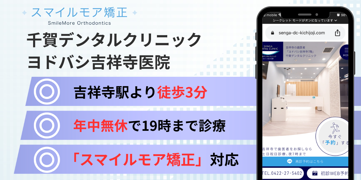 吉祥寺のスマイルモア矯正|千賀デンタルクリニック ヨドバシ吉祥寺医院