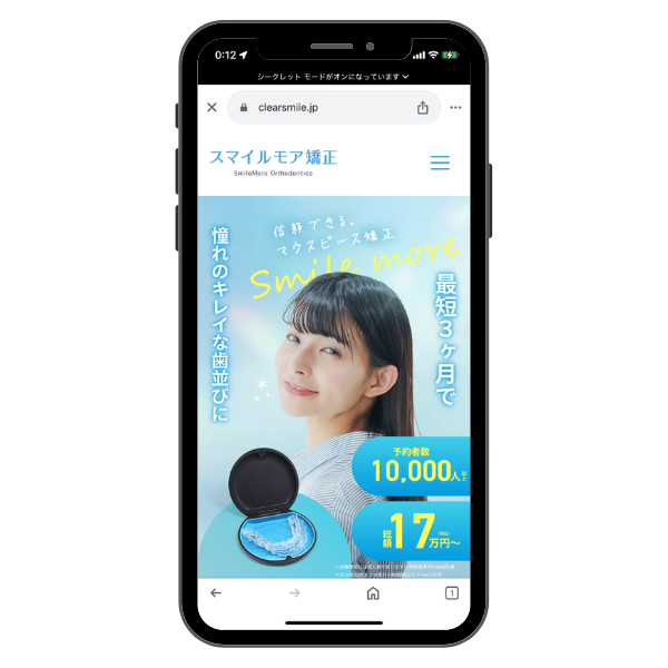 スマイルモア矯正