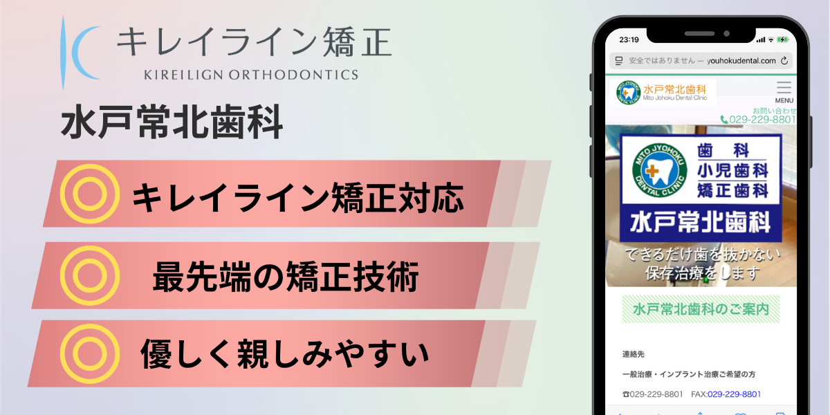 茨木県のキレイライン矯正|水戸常北歯科