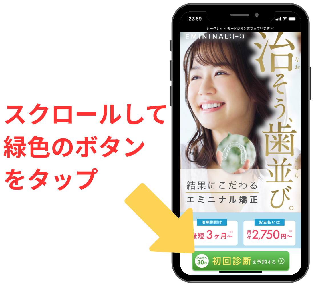エミニナル矯正 予約の流れ