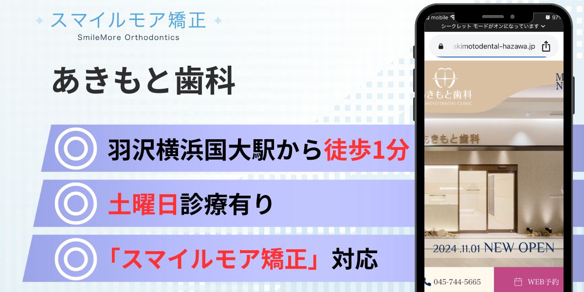 神奈川(横浜)のスマイルモア矯正|あきもと歯科